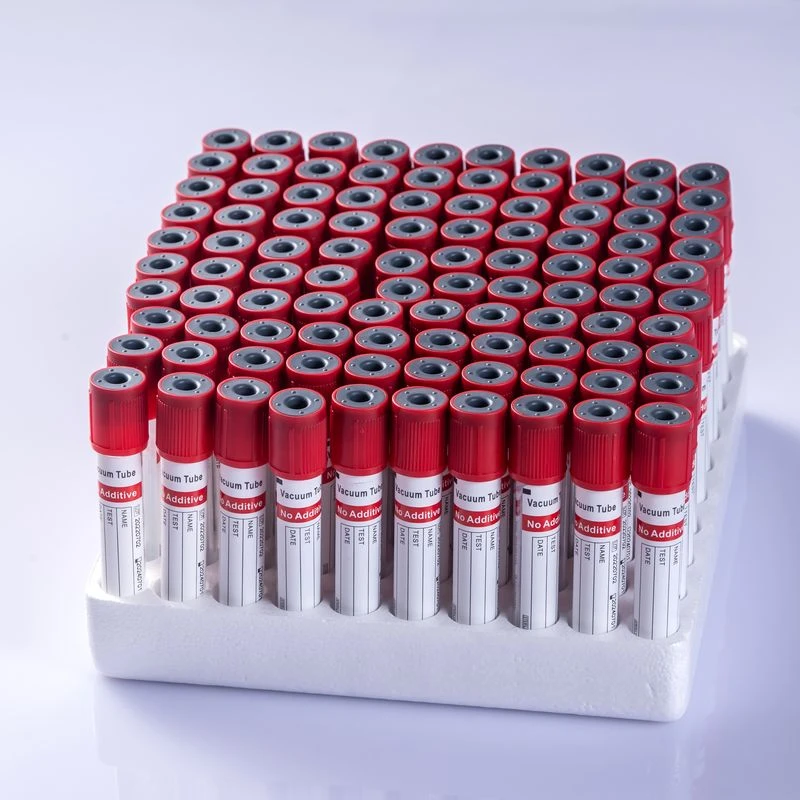 Paprastas vamzdelis - jūsų idealus pasirinkimas norint gauti serumo pavyzdžių klinikinėje biochemijoje, imunologijos ir serologijos testuose